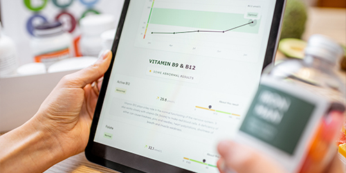 Smart General Ledger